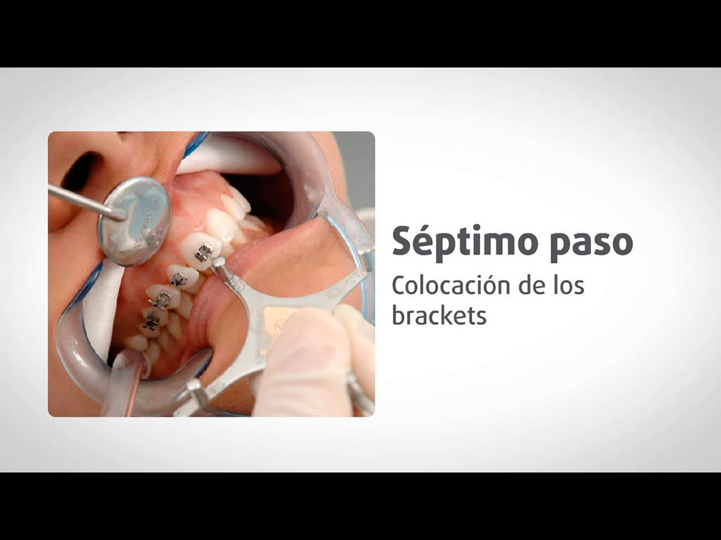 Previsualización del video de Ortodoncia